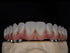 Multilayer Zirconia Block 3DPro Exceptional Strength 800-1200Mpa, 5 Layers Material Produces, All in One